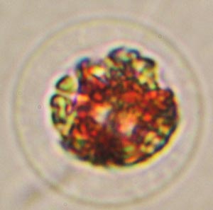 L’algue rouge Haematococcus pluvialis vue au microscope